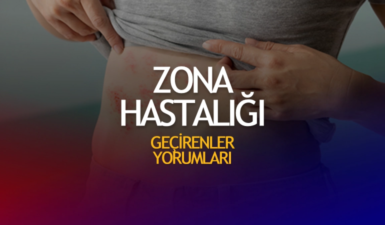 Zona Hastalığı Nedir?